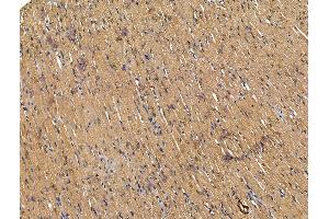 ABIN7094625 and ABIN7098675 at 1/100 staining Rat heart tissue by IHC-P. (FZD4 anticorps  (Internal Region))