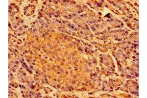 Immunohistochemistry of paraffin-embedded human pancreatic tissue using ABIN7169441 at dilution of 1:100 (SHE anticorps  (AA 2-162))