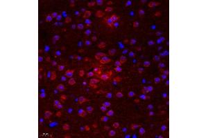 Immunofluorescence of paraffin embedded mouse brain using UTS2 (ABIN7076162) at dilution of 1:2000 (400x lens) (Urotensin 2 anticorps)