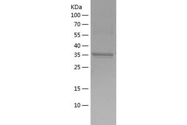GDF3 Protein (AA 251-364) (His-IF2DI Tag)