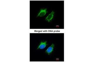 ICC/IF Image Immunofluorescence analysis of paraformaldehyde-fixed HeLa, using Inhibin beta-A , antibody at 1:200 dilution.