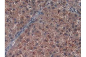 Detection of MPG in Human Liver cancer Tissue using Polyclonal Antibody to N-Methylpurine DNA Glycosylase (MPG)