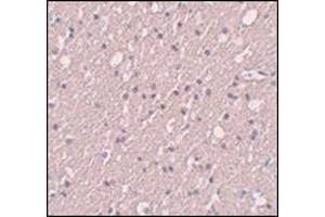 Immunohistochemistry of SIPA1L3 in human brain tissue with this product at 5 μg/ml. (SIPA1L3 anticorps  (N-Term))