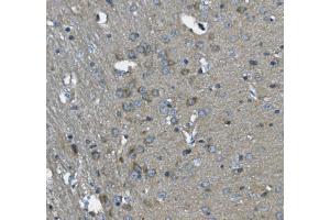 IHC analysis of SCG10/STMN2 using anti-SCG10/STMN2 antibody (ABIN7600734). (STMN2 anticorps  (AA 23-170))