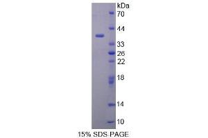 SDS-PAGE analysis of Human MYB Protein. (MYB Protéine)