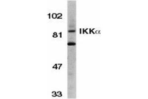 Western blot analysis of IKK alpha in Jurkat whole cell lysate with AP30405PU-N IKK alpha antibody (C3) at 1/500 dilution. (IKK alpha anticorps  (C-Term))