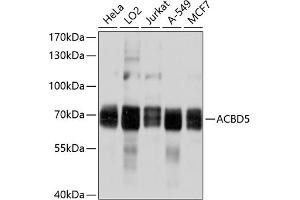 Western blot analysis of extracts of various cell lines, using  antibody (ABIN6131213, ABIN6136419, ABIN6136420 and ABIN6214901) at 1:1000 dilution. (ACBD5 anticorps  (AA 170-440))