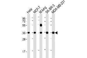 Lane 1: HeLa, Lane 2: MCF-7, Lane 3: mouse lung, Lane 4: SK-BR-3, Lane 5: MDA-MB-231 cell lysate at 20 µg per lane, probed with bsm-51380M WNT4 (1698CT540.