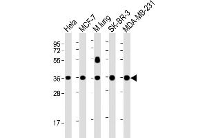 Lane 1: HeLa, Lane 2: MCF-7, Lane 3: mouse lung, Lane 4: SK-BR-3, Lane 5: MDA-MB-231 cell lysate at 20 µg per lane, probed with bsm-51380M WNT4 (1698CT540. (WNT4 anticorps)