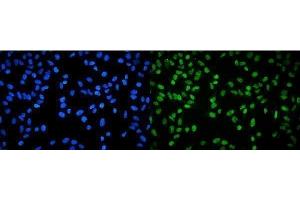 IF analysis of RPA32/RPA2 using anti-RPA32/RPA2 antibody (ABIN7601380). (RPA2 anticorps  (AA 34-254))
