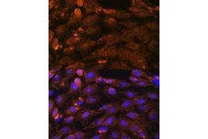 Immunofluorescence analysis of C6 cells using PTCH1 antibody (ABIN1682368, ABIN1682367, ABIN3015342, ABIN3015343 and ABIN6213997) at dilution of 1:100. (Patched 1 anticorps  (AA 1214-1312))