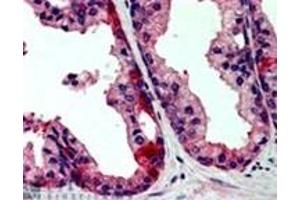 Image no. 1 for anti-TAO Kinase 3 (TAOK3) (Internal Region) antibody (ABIN374459) (TAO Kinase 3 anticorps  (Internal Region))