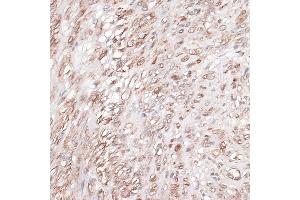 Immunohistochemistry of paraffin-embedded human uterus using L antibody (ABIN7268186) at dilution of 1:100 (40x lens).
