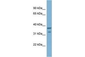 Image no. 1 for anti-Ral GEF with PH Domain and SH3 Binding Motif 2 (RALGPS2) (AA 201-250) antibody (ABIN6742101) (RALGPS2 anticorps  (AA 201-250))