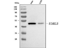 Western blot analysis of RIMKLB using anti-RIMKLB antibody (ABIN7600908).