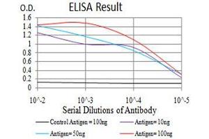 Black line: Control Antigen (100 ng),Purple line: Antigen (10 ng), Blue line: Antigen (50 ng), Red line:Antigen (100 ng)