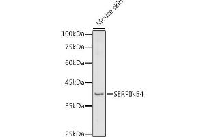 Western blot analysis of extracts of Mouse skin, using SERPINB4 antibody (ABIN7270243) at 1:1000 dilution. (SERPINB4 anticorps  (C-Term))
