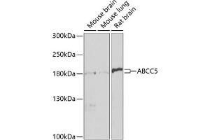 Western blot analysis of extracts of various cell lines, using  antibody (ABIN3017213, ABIN3017214, ABIN3017215 and ABIN6219998) at 1:1000 dilution. (ABCC5 anticorps  (AA 1-179))
