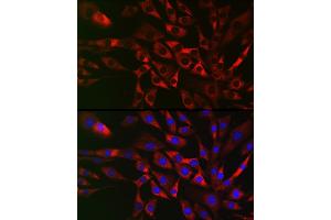 Immunofluorescence analysis of NIH/3T3 cells using TRIP2 Rabbit pAb (ABIN6129947, ABIN6149464, ABIN6149465 and ABIN6222516) at dilution of 1:50 (40x lens).