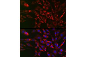 Immunofluorescence analysis of NIH/3T3 cells using TRIP2 Rabbit pAb (ABIN6129947, ABIN6149464, ABIN6149465 and ABIN6222516) at dilution of 1:50 (40x lens). (TRAF3IP2 anticorps  (AA 1-300))