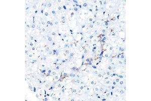 Immunohistochemistry of paraffin-embedded mouse liver using P Glycoprotein Rabbit mAb (ABIN7265732) at dilution of 1:100 (40x lens).