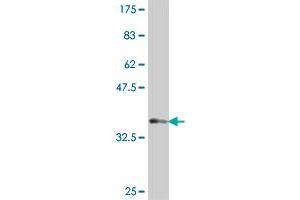 Western Blot detection against Immunogen (37 KDa) .