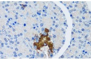 Immunohistochemistry of paraffin-embedded Rat pancreatic islet using TSC1 Polyclonal Antibody at dilution of 1:200 (40x lens). (TSC1 anticorps)