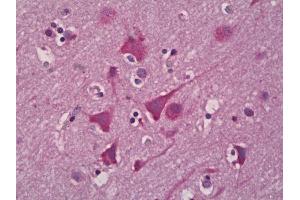Anti-EPHX2 antibody IHC of human brain, cortex neurons. (EPHX2 anticorps)