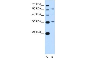 WB Suggested Anti-ZSCAN12 Antibody Titration:  5. (ZSCAN12 anticorps  (N-Term))