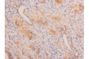 Figure. (TPSAB1 anticorps  (AA 161-262))