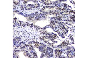 IHC analysis of SQSTM1 using anti-SQSTM1 antibody (ABIN3043937). (SQSTM1 anticorps  (N-Term))