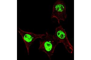 Fluorescent confocal ige of HeLa cells stained with phospho-SD3- antibody. (SMAD3 anticorps  (pSer208))