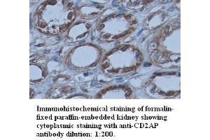 Image no. 1 for anti-CD2-Associated Protein (Cd2ap) (C-Term) antibody (ABIN791046)