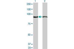 Western Blot analysis of AMPD2 expression in transfected 293T cell line by AMPD2 monoclonal antibody (M04), clone 2G8. (AMPD2 anticorps  (AA 86-185))
