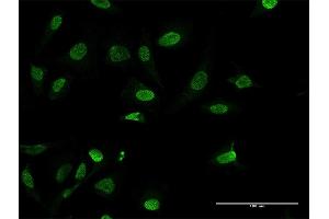 Immunofluorescence of purified MaxPab antibody to HMGA1 on HeLa cell. (HMGA1 anticorps  (AA 1-107))
