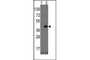 Image no. 1 for anti-Atonal Homolog 1 (Drosophila) (ATOH1) (N-Term) antibody (ABIN357825) (ATOH1 anticorps  (N-Term))