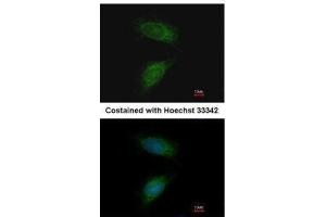 ICC/IF Image Immunofluorescence analysis of methanol-fixed HeLa, using MMP2, antibody at 1:200 dilution.