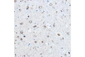 Immunohistochemistry of paraffin-embedded mouse brain using Phospho-Tau-S396 Rabbit mAb (ABIN7268523) at dilution of 1:100 (40x lens).