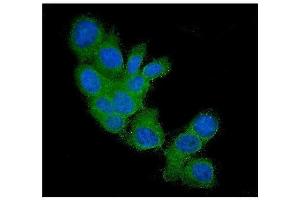 IF analysis of FHIT using anti-FHIT antibody (ABIN5693307).