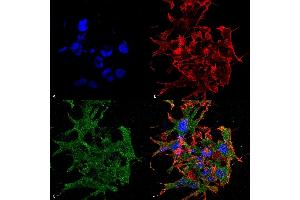 Immunocytochemistry/Immunofluorescence analysis using Mouse Anti-GABA-B Receptor 1 Monoclonal Antibody, Clone S93A-49 (ABIN1027717).