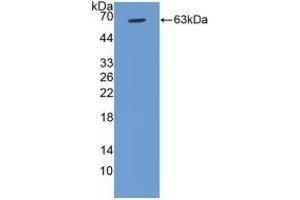Detection of Recombinant CCND1, Human using Polyclonal Antibody to Cyclin D1 (CCND1) (Cyclin D1 anticorps  (AA 1-295))