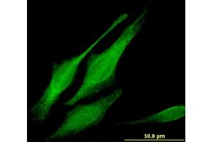 Immunofluorescence of monoclonal antibody to MORG1 on HeLa cell.