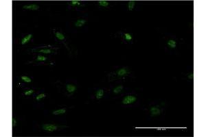 Immunofluorescence of monoclonal antibody to HMGB2 on HeLa cell. (HMGB2 anticorps  (AA 1-195))