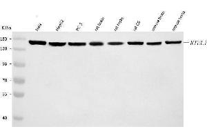 Western blot analysis of RTEL1 using anti-RTEL1 antibody (ABIN7602712).