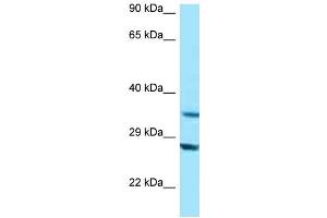WB Suggested Anti-TOMM34 Antibody Titration: 1. (TOMM34 anticorps  (N-Term))