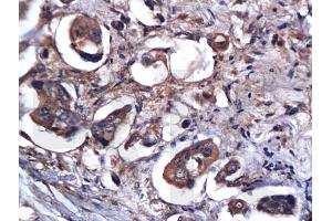 Formalin-fixed and paraffin embedded rat brain labeled with Anti-Caspase-9 Polyclonal Antibody, Unconjugated (ABIN724160) 1:200 followed by conjugation to the secondary antibody and DAB staining