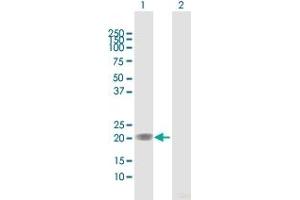 Western Blot analysis of MGMT expression in transfected 293T cell line by MGMT MaxPab polyclonal antibody.