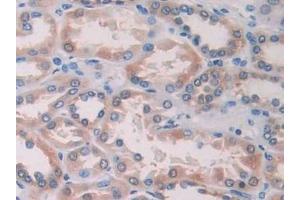 Detection of IL15 in Human Kidney Tissue using Polyclonal Antibody to Interleukin 15 (IL15)