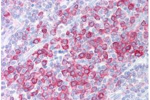 Human Tonsil (formalin-fixed, paraffin-embedded) stained with C1QTNF4 antibody ABIN213915 at 5 ug/ml followed by biotinylated goat anti-rabbit IgG secondary antibody ABIN481713, alkaline phosphatase-streptavidin and chromogen. (C1QTNF4 anticorps  (C-Term))