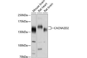 Western blot analysis of extracts of various cell lines, using CD2 antibody (ABIN6130178, ABIN6137811, ABIN6137812 and ABIN6214454) at 1:1000 dilution.
